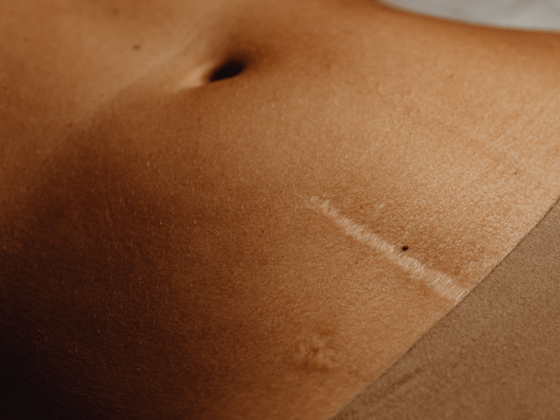 Necesaria imperfección