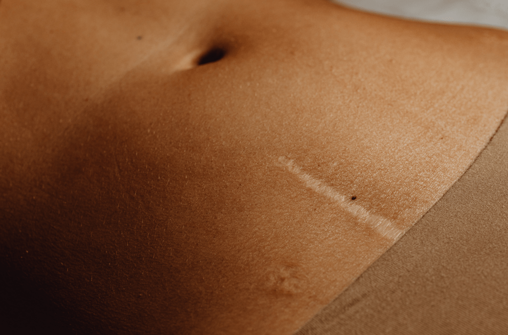 Necesaria imperfección