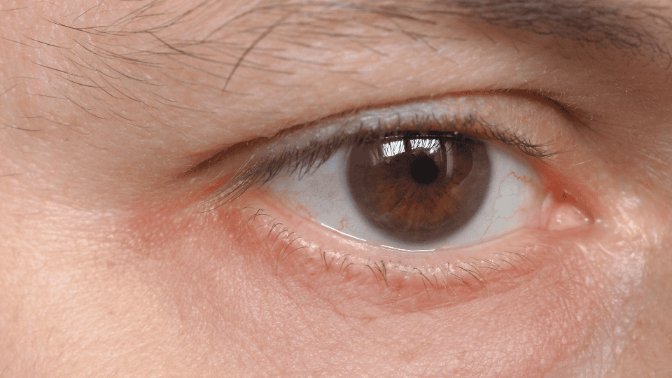 En esta intensidad de miradas la esclerótica se&nbsp;desborda